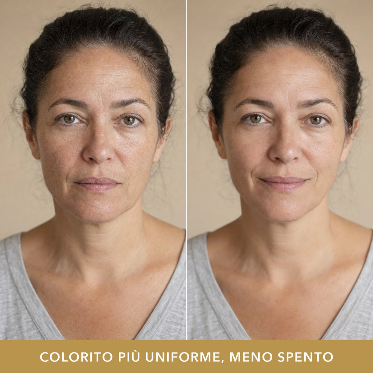 Colorito più uniforme: prima e dopo