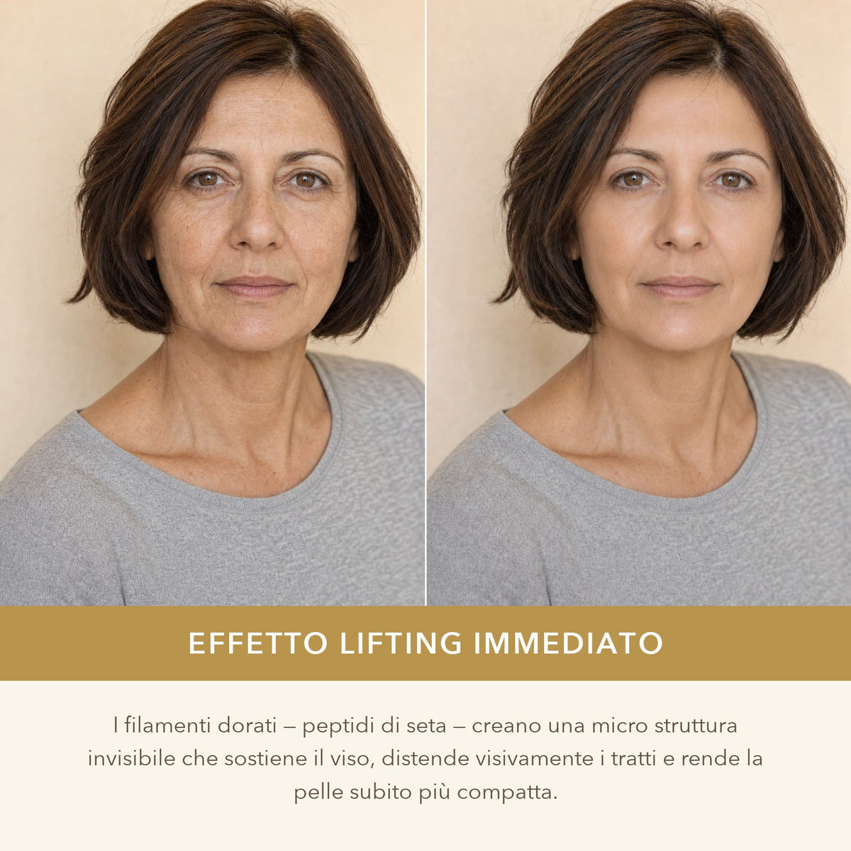 Effetto lifting immediato: prima e dopo