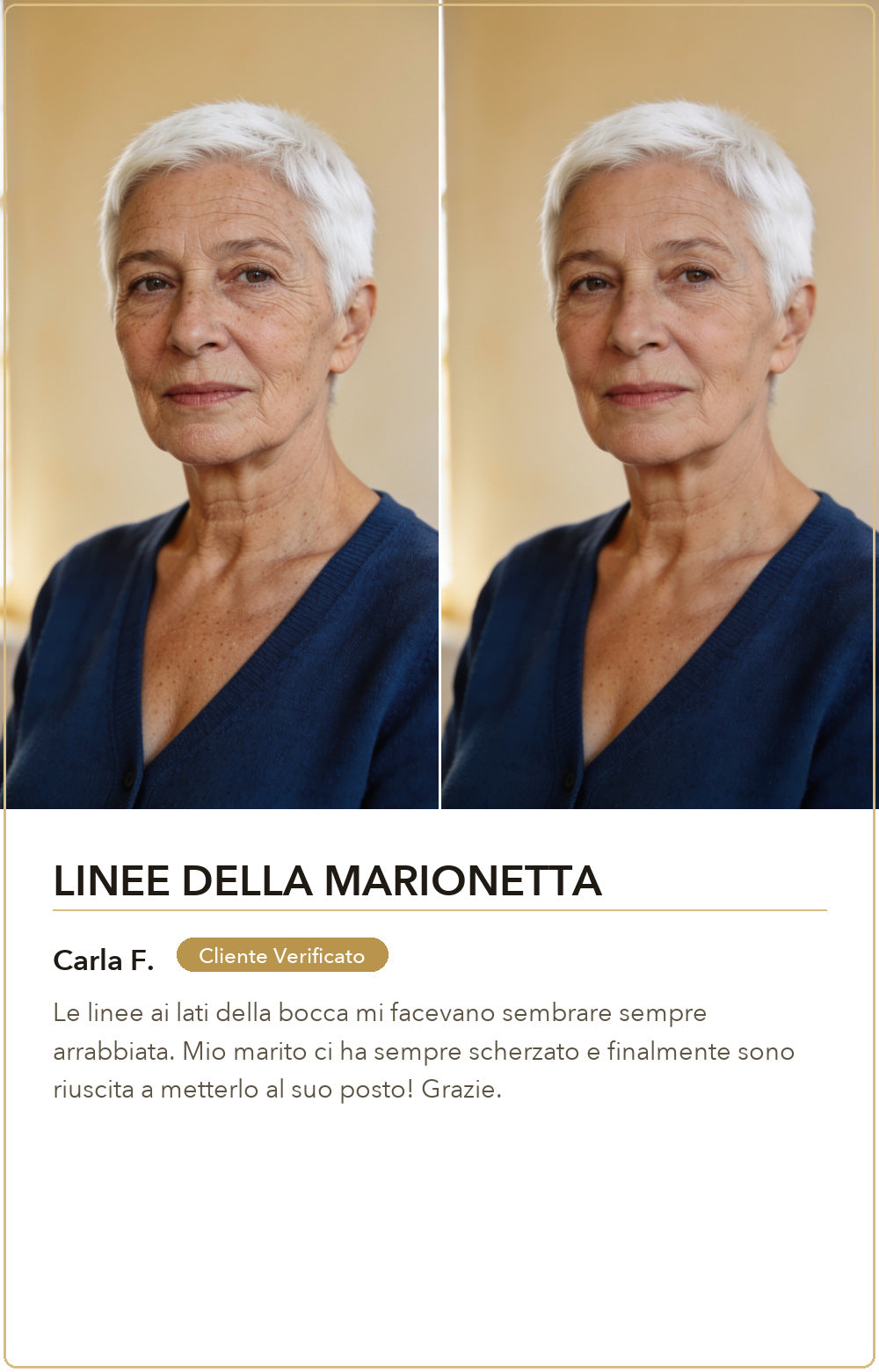 Linee della marionetta